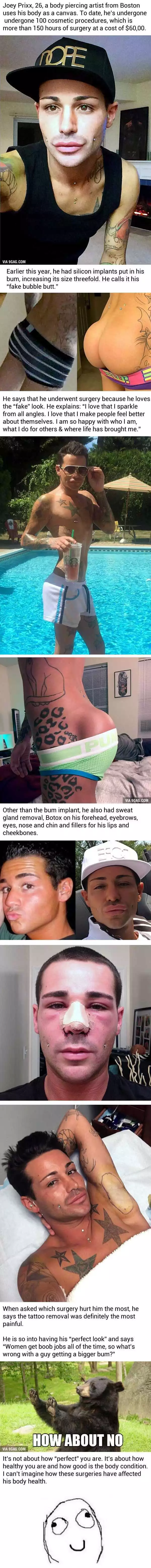 This Guy Spent $60,000 [N23.5Million] On Surgeries, Including Making His Butt Perfect